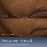 Advanced Night Repair Synchronized Multi-Recovery Complex Serum