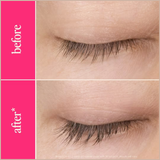 GrandeLASH-MD Lash Enhancing Serum – 6 Month Supply – Longer, Thicker & Healthier-Looking Lashes